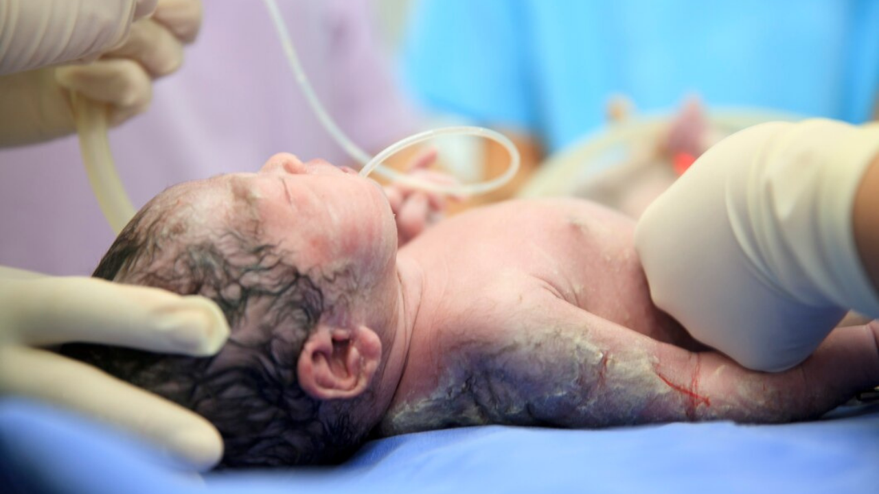 A Cradle for the Unseen, Caring for Premature Babies in Tribal India